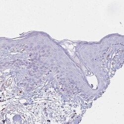 Invitrogen TTYH1 Polyclonal Antibody 100 &mu;L; Unconjugated:Antibodies,