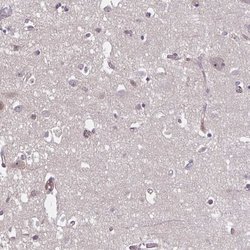Invitrogen HMBS Polyclonal Antibody 100 &mu;L; Unconjugated:Antibodies,