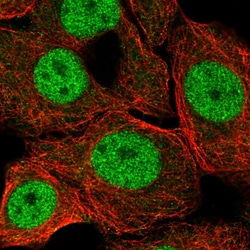 Invitrogen ZBTB14 Polyclonal Antibody 100 &mu;L; Unconjugated:Antibodies,