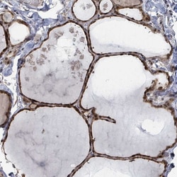 Invitrogen ZBTB14 Polyclonal Antibody 100 &mu;L; Unconjugated:Antibodies,
