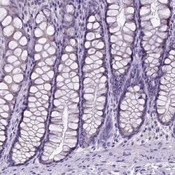 Invitrogen SPEF1 Polyclonal Antibody 100 &mu;L; Unconjugated:Antibodies,