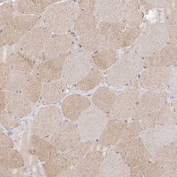 Invitrogen ISLR Polyclonal Antibody 100 &mu;L; Unconjugated:Antibodies,
