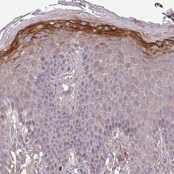 Invitrogen ISLR Polyclonal Antibody 100 &mu;L; Unconjugated:Antibodies,