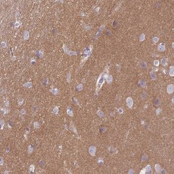 Invitrogen SLC8A2 Polyclonal Antibody 100 &mu;L; Unconjugated:Antibodies,