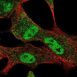 Invitrogen SLC25A45 Polyclonal Antibody 100 &mu;L; Unconjugated:Antibodies,