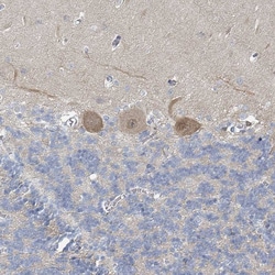 Invitrogen SLC25A45 Polyclonal Antibody 100 &mu;L; Unconjugated:Antibodies,