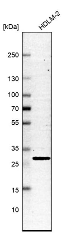 Invitrogen SLC25A45 Polyclonal Antibody 100 &mu;L; Unconjugated:Antibodies,