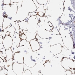 Invitrogen TUSC5 Polyclonal Antibody 100 &mu;L; Unconjugated:Antibodies,