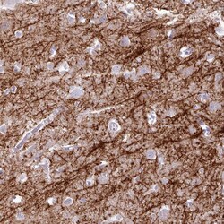 Invitrogen BDKRB2 Polyclonal Antibody 100 &mu;L | Buy Online | Invitrogen&trade; | Fisher Scientific