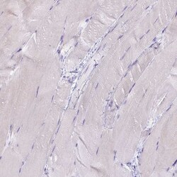 Invitrogen BDKRB2 Polyclonal Antibody 100 &mu;L | Buy Online | Invitrogen&trade; | Fisher Scientific