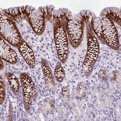 Invitrogen BDKRB2 Polyclonal Antibody 100 &mu;L | Buy Online | Invitrogen&trade; | Fisher Scientific