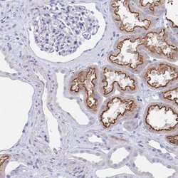 Tnfaip6 Polyclonal Antibody, Invitrogen 100 &mu;L; Unconjugated:Anticorps,