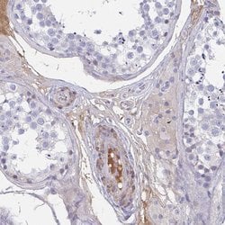 Tnfaip6 Polyclonal Antibody, Invitrogen 100 &mu;L; Unconjugated:Anticorps,