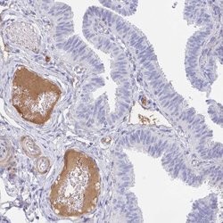Tnfaip6 Polyclonal Antibody, Invitrogen 100 &mu;L; Unconjugated:Anticorps,