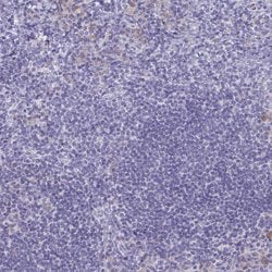 Tnfaip6 Polyclonal Antibody, Invitrogen 100 &mu;L; Unconjugated:Anticorps,