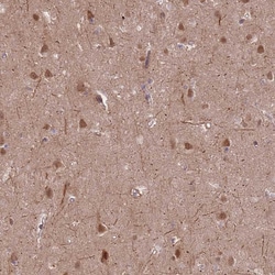 Invitrogen ZNF391 Polyclonal Antibody 100 &mu;L; Unconjugated:Antibodies,
