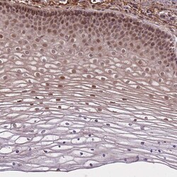 Invitrogen ZNF391 Polyclonal Antibody 100 &mu;L; Unconjugated:Antibodies,