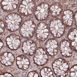 Invitrogen ZNF391 Polyclonal Antibody 100 &mu;L; Unconjugated:Antibodies,
