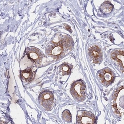 Invitrogen CCDC48 Polyclonal Antibody 100 &mu;L; Unconjugated:Antibodies,
