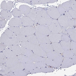 Invitrogen RTP5 Polyclonal Antibody 100 &mu;L; Unconjugated:Antibodies,