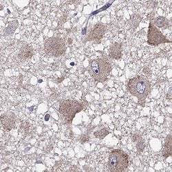 Invitrogen RTP5 Polyclonal Antibody 100 &mu;L; Unconjugated:Antibodies,