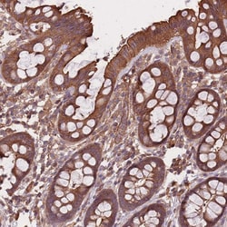 Invitrogen C10orf76 Polyclonal Antibody 100 &mu;L; Unconjugated:Antibodies,