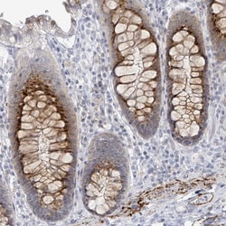 Invitrogen C10orf99 Polyclonal Antibody 100 &mu;L; Unconjugated:Antibodies,
