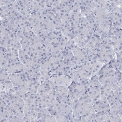 Invitrogen C10orf99 Polyclonal Antibody 100 &mu;L; Unconjugated:Antibodies,