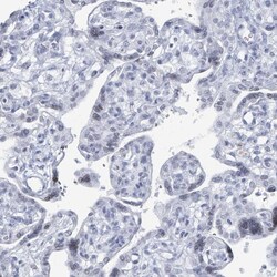 Invitrogen C10orf99 Polyclonal Antibody 100 &mu;L; Unconjugated:Antibodies,