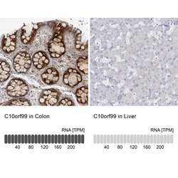 Invitrogen C10orf99 Polyclonal Antibody 100 &mu;L; Unconjugated:Antibodies,