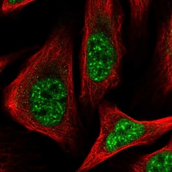 Invitrogen C14orf140 Polyclonal Antibody 100 &mu;L; Unconjugated:Antibodies,