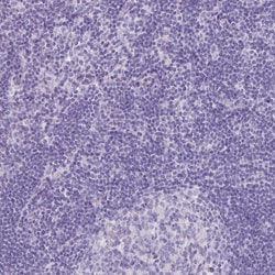 Invitrogen CYSTM1 Polyclonal Antibody 100 &mu;L; Unconjugated:Antibodies,