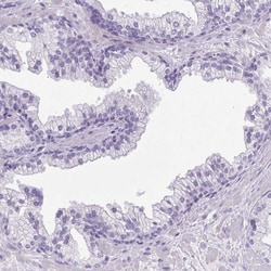 Invitrogen CYSTM1 Polyclonal Antibody 100 &mu;L; Unconjugated:Antibodies,