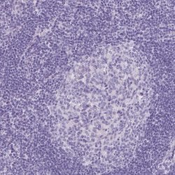 Invitrogen CYSTM1 Polyclonal Antibody 100 &mu;L; Unconjugated:Antibodies,