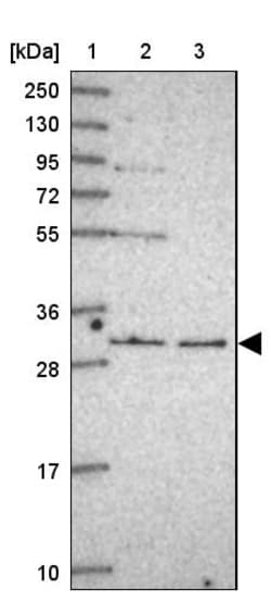 Invitrogen RNF170 Polyclonal Antibody 100 &mu;L; Unconjugated:Antibodies,