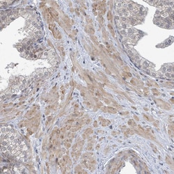 Invitrogen SBF2 Polyclonal Antibody 100 &mu;L; Unconjugated:Antibodies,