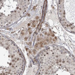 Invitrogen SBF2 Polyclonal Antibody 100 &mu;L; Unconjugated:Antibodies,