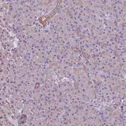Invitrogen LYPLA1 Polyclonal Antibody 100 &mu;L; Unconjugated:Antibodies,