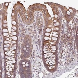 Invitrogen VENTX Polyclonal Antibody 100 &mu;L; Unconjugated:Antibodies,