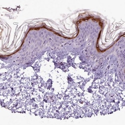 Invitrogen SLURP1 Polyclonal Antibody 100 &mu;L; Unconjugated:Antibodies,