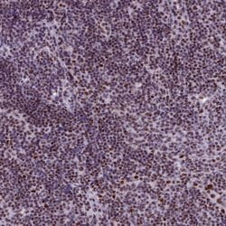 Invitrogen SRSF4 Polyclonal Antibody 100 &mu;L; Unconjugated:Antibodies,