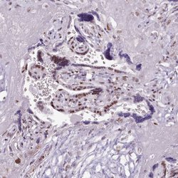 Invitrogen SRSF4 Polyclonal Antibody 100 &mu;L; Unconjugated:Antibodies,