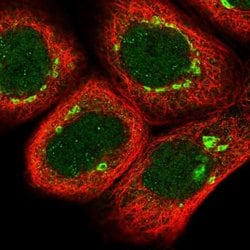 Invitrogen ZBED5 Polyclonal Antibody 100 &mu;L; Unconjugated:Antibodies,