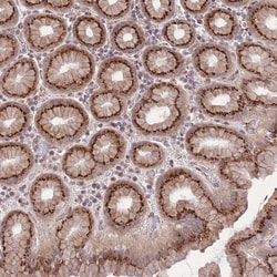 Invitrogen ZBED5 Polyclonal Antibody 100 &mu;L; Unconjugated:Antibodies,