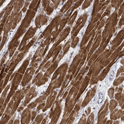 Invitrogen FAM47B Polyclonal Antibody 100 &mu;L; Unconjugated:Antibodies,