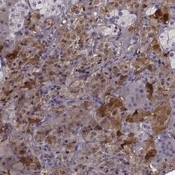 Invitrogen PNMT Polyclonal Antibody 100 &mu;L; Unconjugated:Antibodies,