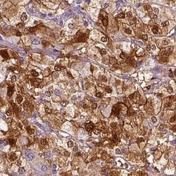 Invitrogen PNMT Polyclonal Antibody 100 &mu;L; Unconjugated:Antibodies,