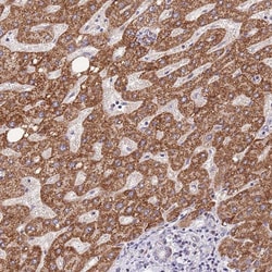 Invitrogen TOPAZ1 Polyclonal Antibody 100 &mu;L; Unconjugated:Antibodies,
