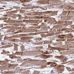 Invitrogen LMOD2 Polyclonal Antibody 100 &mu;L; Unconjugated:Antibodies,