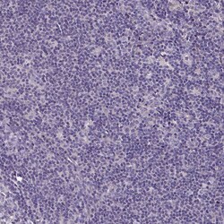 Invitrogen LMOD2 Polyclonal Antibody 100 &mu;L; Unconjugated:Antibodies,